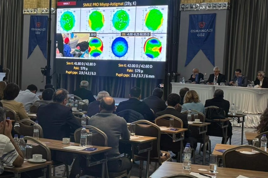 Bursa&rsquo;da 50 profes&ouml;rden canlı g&ouml;z ameliyatı şovu